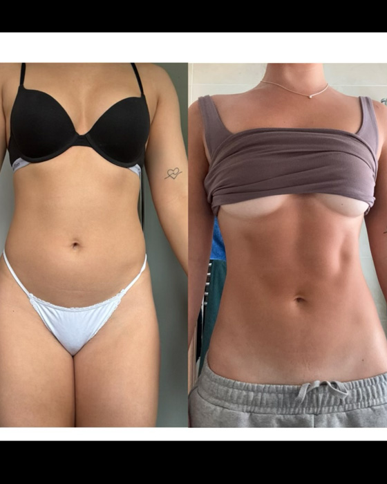 Transformation 3